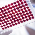 Blood test for immunoglobulin: general recommendations