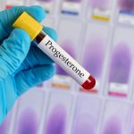 Blood test for progesterone