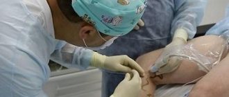 Доктор Семенов А.Ю. проводит лечение варикоза лазером – без скальпеля и разрезов