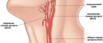 Where is the carotid artery located in the human neck?