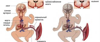 Fetal hypoxia