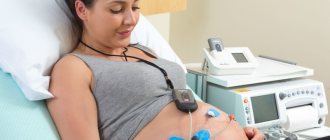 Holter ECG during pregnancy, what to pay attention to