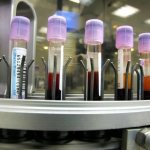 Study of blood composition in humans