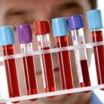 how to reduce the growth of red blood cells in the blood