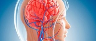 Cerebrovascular accident symptoms and treatment