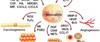 Neutrophils are associated with tumor growth and spread.