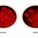 Normal hemoglobin level in men
