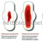 Normal discharge during menstruation