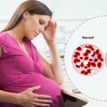 Hemoglobin norms during pregnancy: how does its level change?