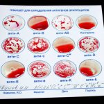 Determination of blood groups