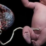 The umbilical cord and its role in childbirth