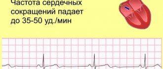 Sinus bradyarrhythmia in a child or teenager. What is it, playing sports 