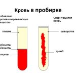 Сыворотка крови человека: что это такое и как ее получить