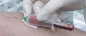 Taking blood from a vein using a vacuum system